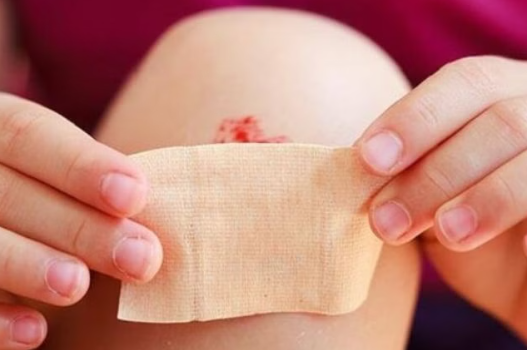 Sơ cứu vết thương hở đúng cách ác bước sơ cứu hiệu quả, từ làm sạch đến ngăn ngừa nhiễm trùng.